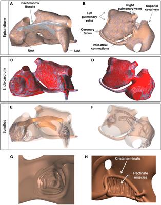 Epicardial Fibrosis Explains Increased Endo–Epicardial Dissociation and Epicardial Breakthroughs in Human Atrial Fibrillation